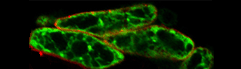 GFP in root endoplasmic reticulum